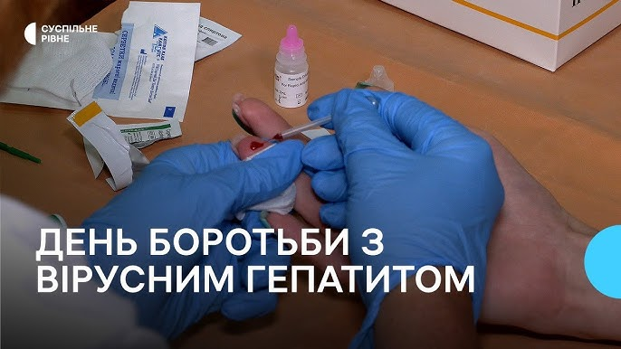 геп 2